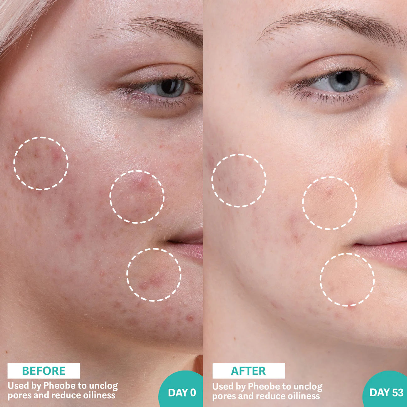 Salicylic Acid & Sea Kelp Pore Clearing and Oil Control Serum The Inkey List